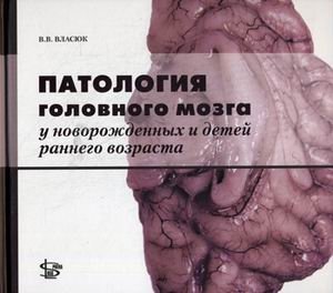Патология головного мозга у новорожденных и детей раннего возраста фото книги
