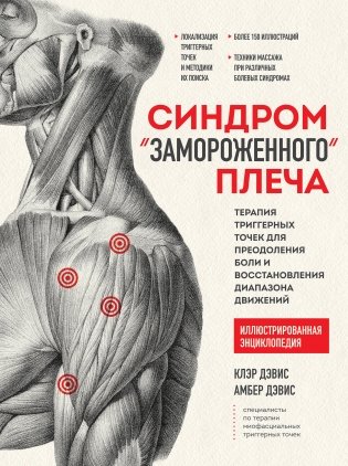 Синдром «замороженного» плеча. Терапия триггерных точек для преодоления боли и восстановления диапазона движений фото книги