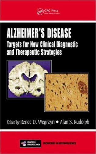 Alzheimer&apos;s Disease фото книги