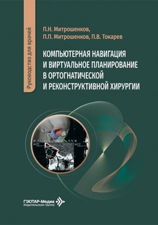 Компьютерная навигация и виртуальное планирование в ортогнатической и реконструктивной хирургии: руководство для врачей фото книги