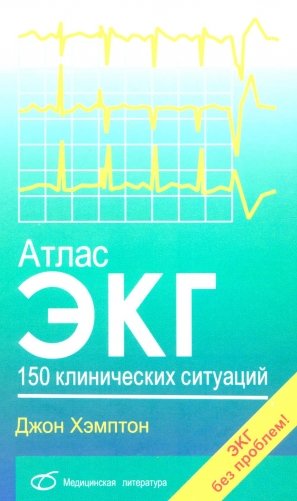 Атлас ЭКГ: 150 клинических ситуаций фото книги