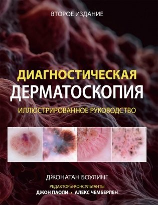 Диагностическая дерматоскопия: иллюстрированное руководство. 2-е изд фото книги