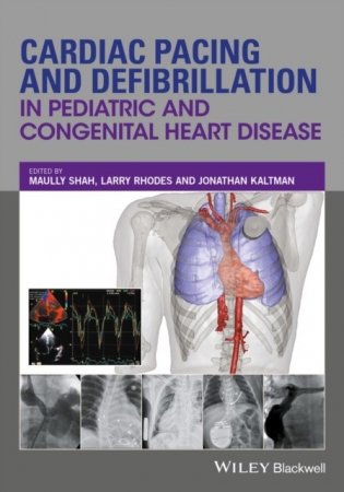 Cardiac Pacing and Defibrillation in Pediatric and Congenital Heart Disease фото книги