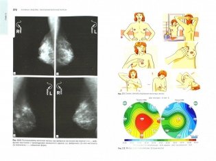 Маммология. Национальное руководство фото книги 2
