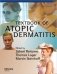 Textbook Atopic Dermatitis фото книги маленькое 2