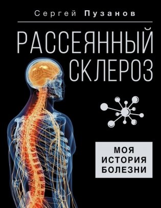 Рассеянный склероз. Моя история болезни фото книги