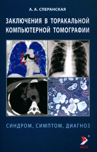 Заключение в торакальной компьютерной томографии. Симптом, синдром, диагноз фото книги