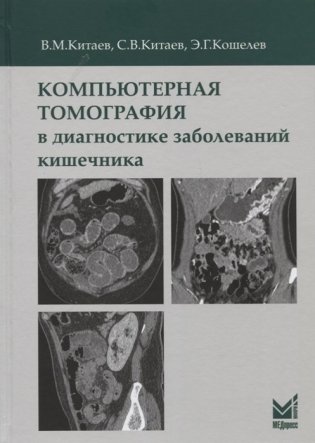 Компьютерная томография в диагностике заболеваний кишечника фото книги