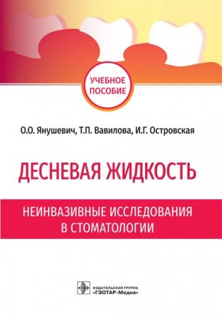 Десневая жидкость. Неинвазивные исследования в стоматологии фото книги