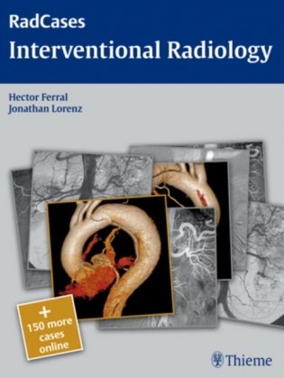 Rad cases: Interventional Radiology фото книги