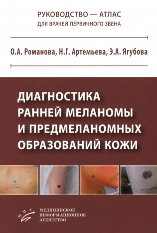 Диагностика ранней меланомы и предмеланомных образований кожи: Руководство - атлас для врачей первичного звена фото книги