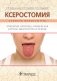 Ксеростомия (сухость полости рта). Этиология, патогенез, клиническая картина, диагностика и лечение фото книги маленькое 2