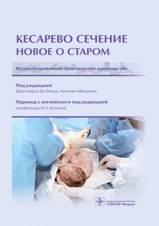 Кесарево сечение. Новое о старом фото книги