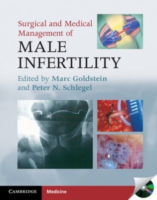 Surgical and Medical Management of Male Infertility фото книги