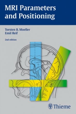 MRI Parameters and Positioning фото книги