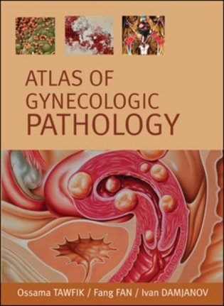 Atlas of Gynecological Pathology. 2007 фото книги