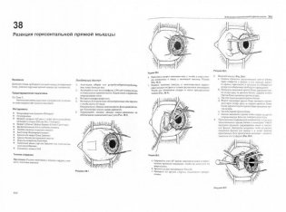 Офтальмохирургия фото книги 2