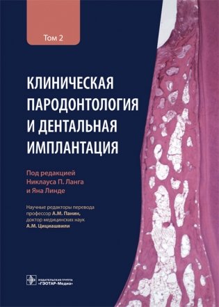 Клиническая пародонтология и дентальная имплантация. Том 2 фото книги