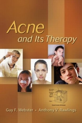 Acne And Its Therapy фото книги