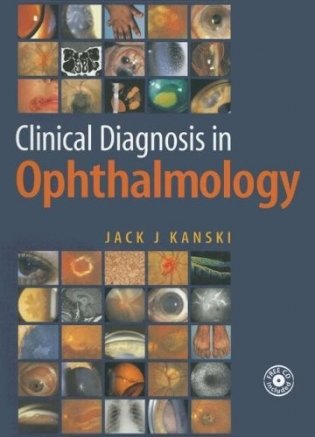 Clinical Diagnosis in Ophthalmology фото книги