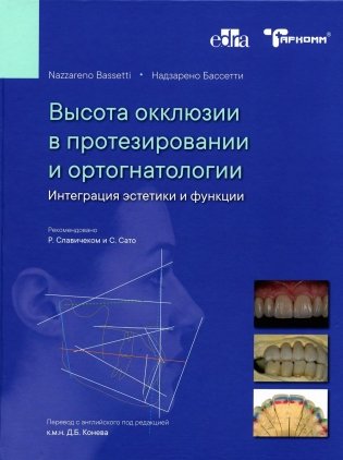 Высота окклюзии в протезировании и ортогнатологии. Интеграция эстетики и функции фото книги