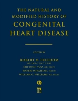 The Natural and Modified History of Congenital Heart Dis. фото книги