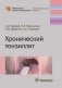 Хронический тонзиллит фото книги маленькое 2