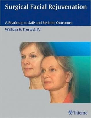 Surgical Facial Rejuvenation. A Roadmap to Safe and Reliable Outcomes фото книги