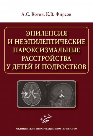 Эпилепсия и неэпилептические пароксизмальные расстройства у детей и подростков фото книги