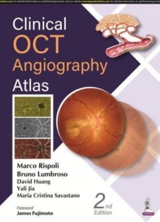 Clinical oct angiography atlas фото книги