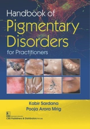 Handbook Of Pigmentary Disorders For Practitioners (Hb 2019) фото книги