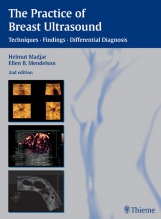 The Practice of Breast Ultrasound: Techniques, Findings, Differential Diagnosis фото книги