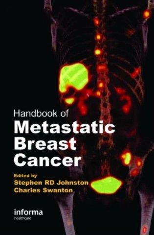 Handbook Of Metastatic Breast Cancer фото книги