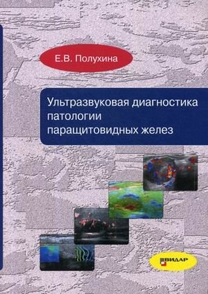 Ультразвуковая диагностика патологии паращитовидных желез. Руководство фото книги