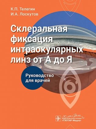 Склеральная фиксация интраокулярных линз от А до Я: руководство для врачей фото книги
