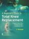 A Beginners Guide To Total Knee Replacement 5 Surgical Video Dvds And 2 Videobook Dvds And 2 Audiobook фото книги маленькое 2