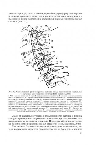 Рентгенометрия позвоночника фото книги 15