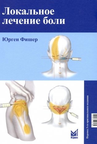 Локальное лечение боли. 11-е изд фото книги