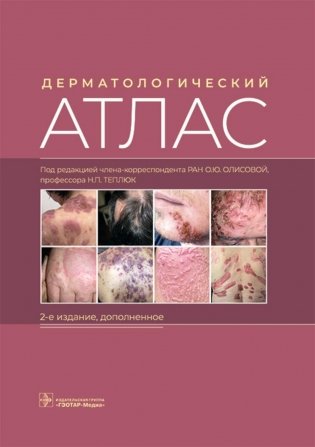 Дерматологический атлас. 2-е изд., доп фото книги