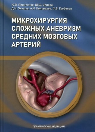 Микрохирургия сложных аневризм средних мозговых артерий: гигантских, фузиформных и частично тромбированных фото книги