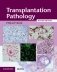 Transplantation Pathology Hardback with Online Resource фото книги маленькое 2