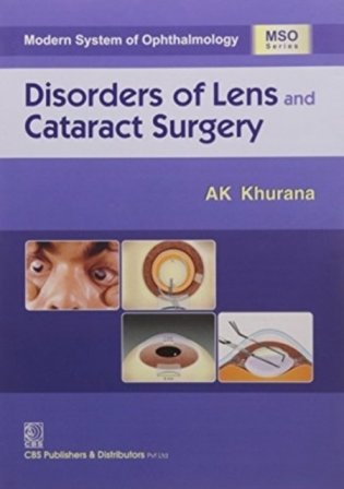 Modern System of Ophthalmology: Disorders of Lens & Cataract Surgery (HB) фото книги