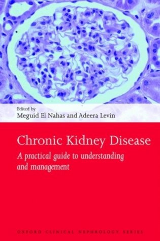 Chronic Kidney Disease фото книги