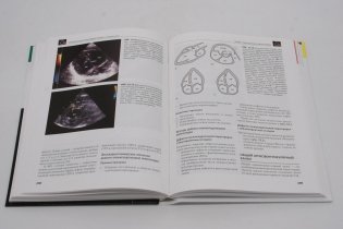 Клиническая эхокардиография: основной курс фото книги 3