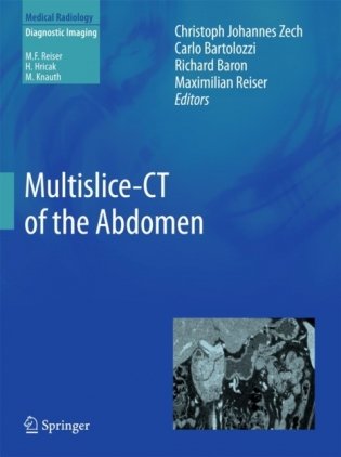 Multislice-CT of the Abdomen фото книги