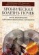 Хроническая болезнь почек. Место нестероидных противовоспалительных препаратов: монография фото книги маленькое 2