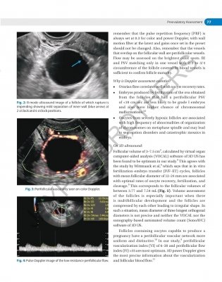 Decision Making In Transvaginal Sonography фото книги 5