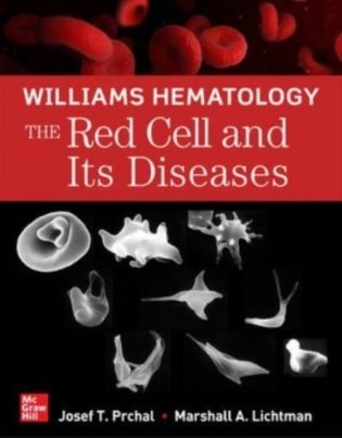 Williams Hematology: The Red Cell and Its Diseases фото книги