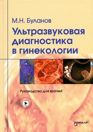 Ультразвуковая диагностика в гинекологии. Руководство для врачей фото книги