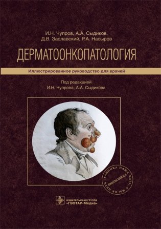Дерматоонкопатология фото книги